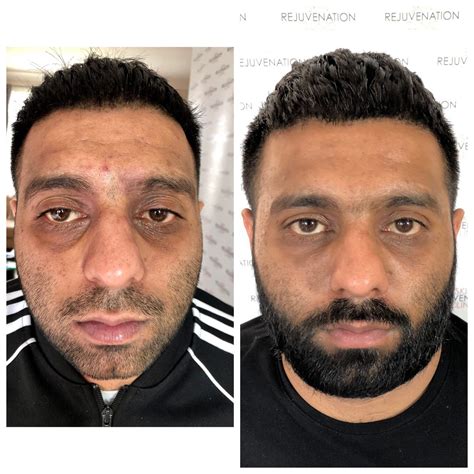 Skin Rejuvenation Clinic