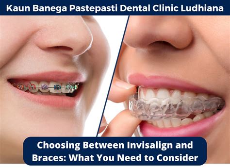 Choosing Between Invisalign And Braces What You Need To Consider