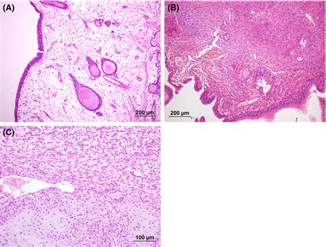 Canine Polypoid Disease And Vagina Telegraph