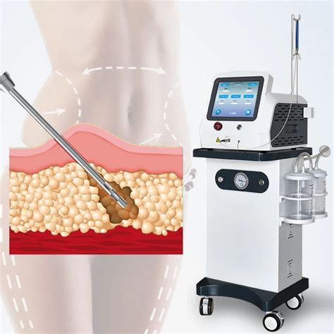 30w 980nm Diode Laser Lipolysis Liposuction Machine Plastic Surgery