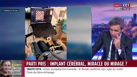 Les partis pris Implant cérébral miracle ou mirage Le mur de la