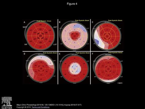 Echocardiographic Assessment Of Left Ventricular Systolic Function An