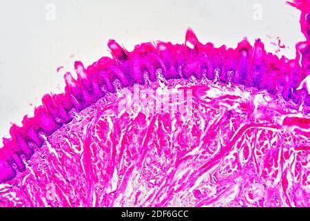 Tongue section showing taste buds, striated muscles and connective tissue. Optical microscope ...