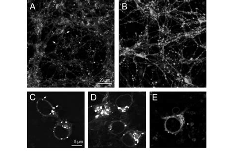 Representative Microphotographs Demonstrating Lysosomal Membrane