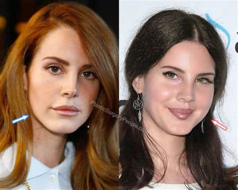 Lana Del Rey: BEFORE and AFTER 2019