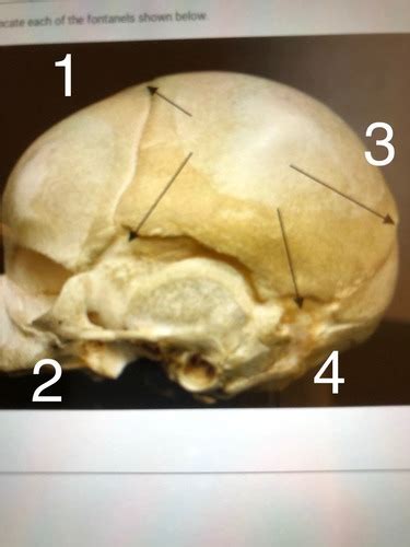 Anatomy Skull Bones Flashcards Quizlet