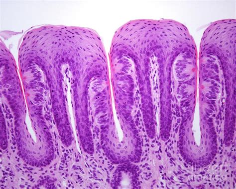 Filiform Papillae Histology