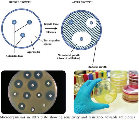 Antimicrobial Susceptibility Testing