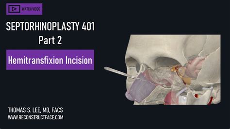 Surgery: Hemitransfixion Incision, Developing septal mucosal flap ...