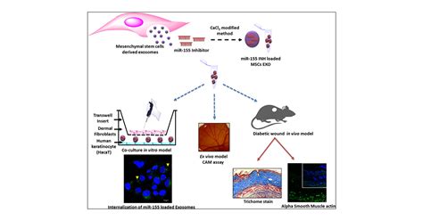 Mesenchymal Stem Cell Derived Exosomes Loaded With MiR 155 Inhibitor