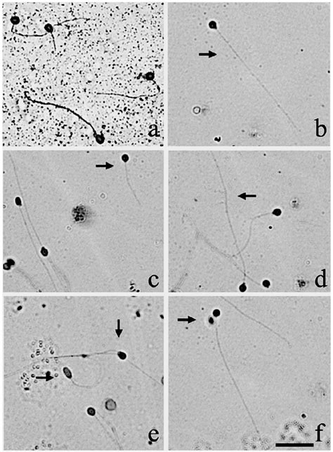 Photomicrograph Of S Melanodermatum Sperm Visualized Under Brightfield Download Scientific