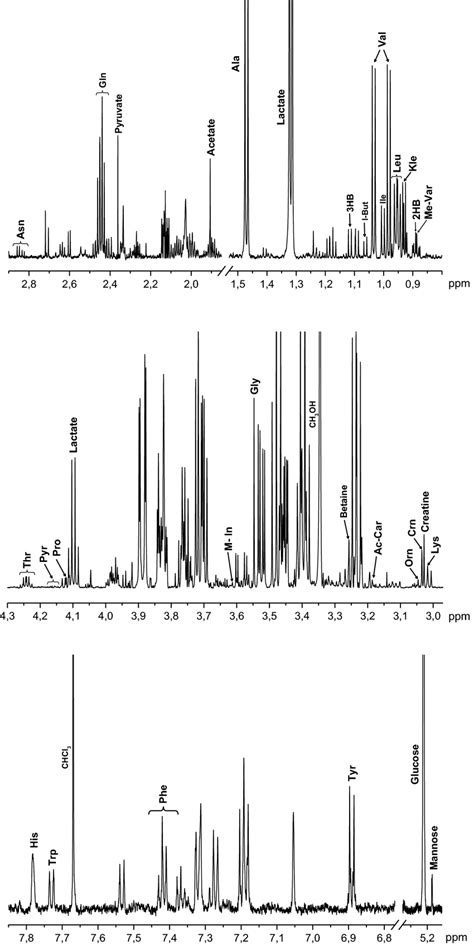 Representative ¹H NMR spectra of protein free lipid free sample