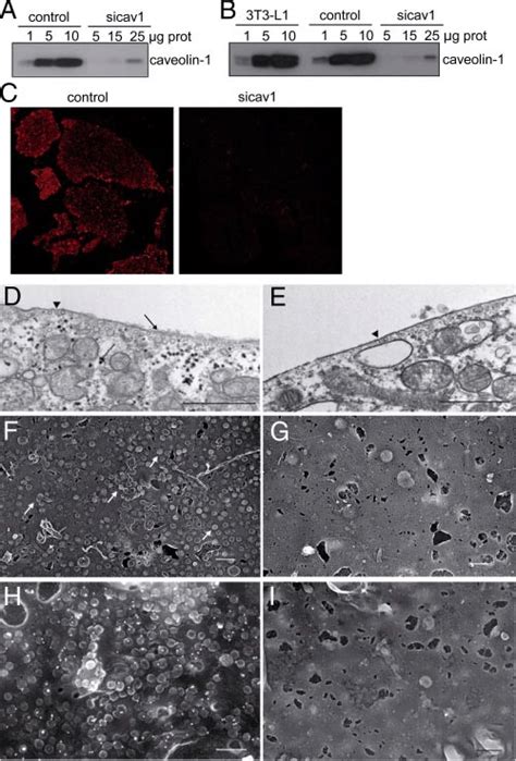 SiRNA Mediated Down Regulation Of Caveolin 1 Expression In 3T3 L1