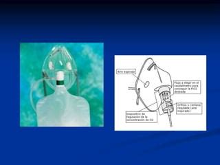 Enfermedades Respiratorias Y Oxigenoterapia Domiciliaria Ppt