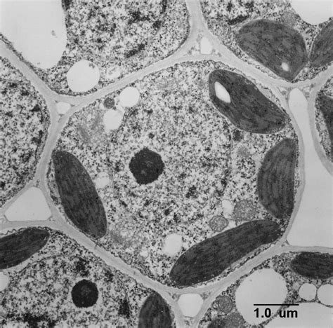 TEM Of Plant Cell