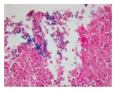 Histopathology of closure site (H&E, 50x). (a) Purulent exudate at site ...