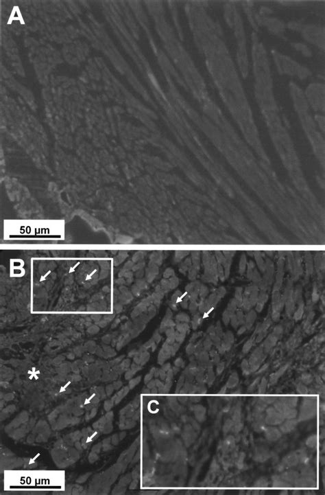 Time Dependent Migration Of Systemically Delivered Bone Marrow