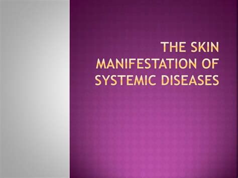 The Skin Manifestation Of Systemic Diseases Ppt