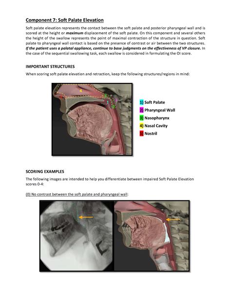 Soft Palate Elevation Sppa Studocu