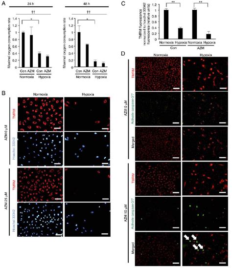 Figure From In Vitro Anticancer Effect Of Azithromycin Targeting