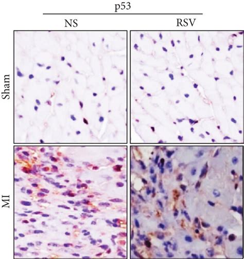 Rsv Decreased Expression Of Senescence Markers In The Mouse Heart