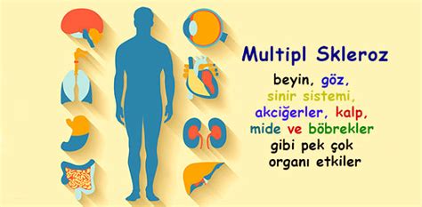 Multipl Skleroz MS hastalığı neden olur Belirtileri ve tedavisi