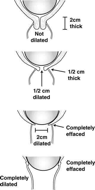 Stages of Labor