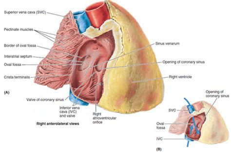 Fossa Ovalis - Patent foramen ovale and atrial septal ...