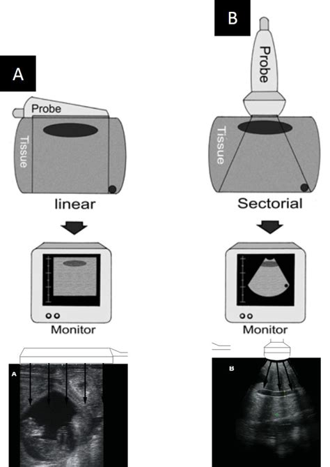 Ultrasonography Usg Dan Aplikasinya Pada Pemeriksaan Organ Reproduksi Serta Diagnosa