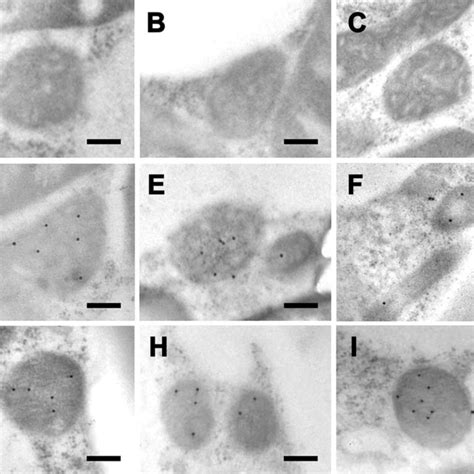 Immuno Electron Microscopy Showing Localization Of Osippi Sgfp And