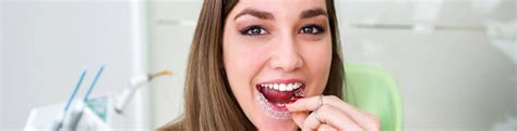 Is It Possible To Straighten Your Teeth Without Braces Bupa