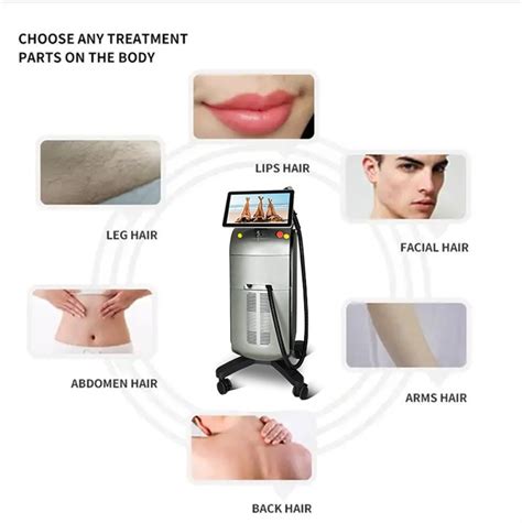 China Professional Alma Soprano Titanium Laser Hair Removal Machine