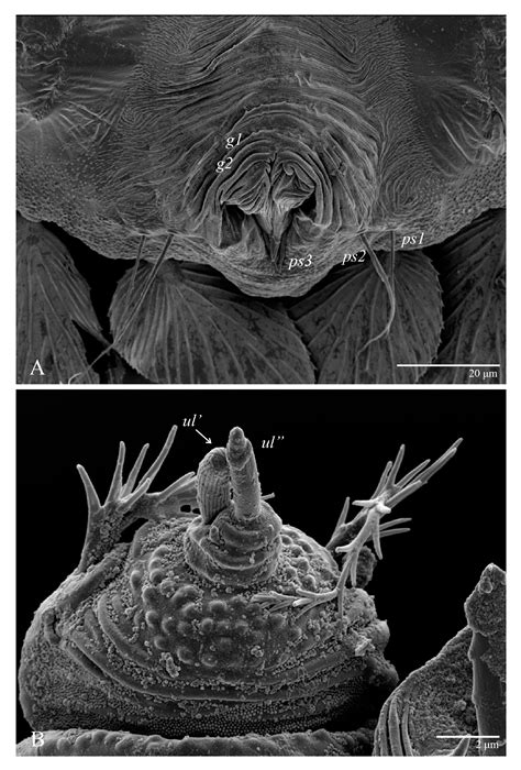 Animals Free Full Text A New Species Of Ultratenuipalpus Acari