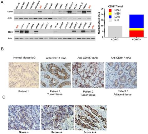 Cdh Expression In A Panel Of Gastric Cancer Cell Lines And In Gastric