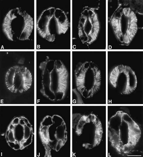 Micrographs Of Cortical Microtubules In Guard Cells Of Vicia Faba