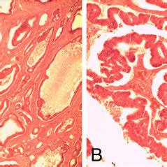 Hematoxylin And Eosin Stained Sections Of Skin Photomicrograph A