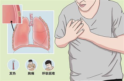 大学生提行李爬楼突发胸痛患气胸专家瘦高男生尤要警惕 腾讯新闻