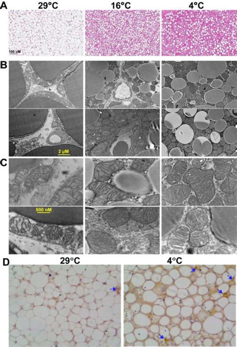 Changes In BAT Upon Adaptation To Cold A Representative Images Of