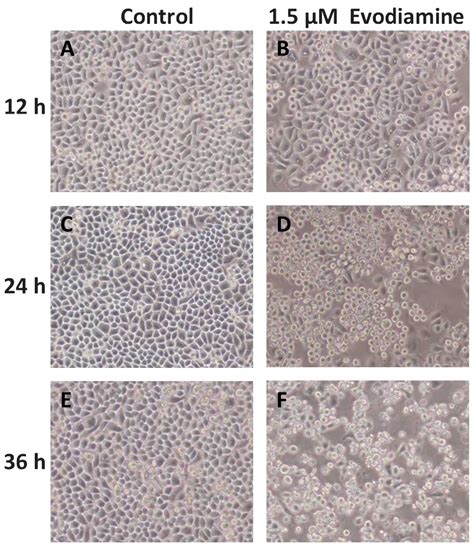 Growth Inhibition And Induction Of Apoptosis In SGC7901 Human Gastric