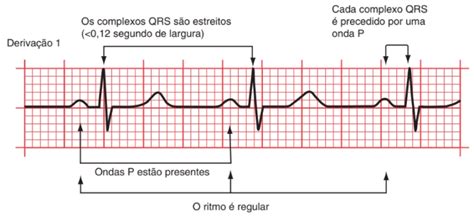 O Que é Eletrocardiograma Como Realizar A Leitura