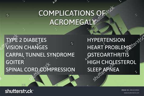 Complications Acromegaly Vector Illustration Medical Journal Stock ...