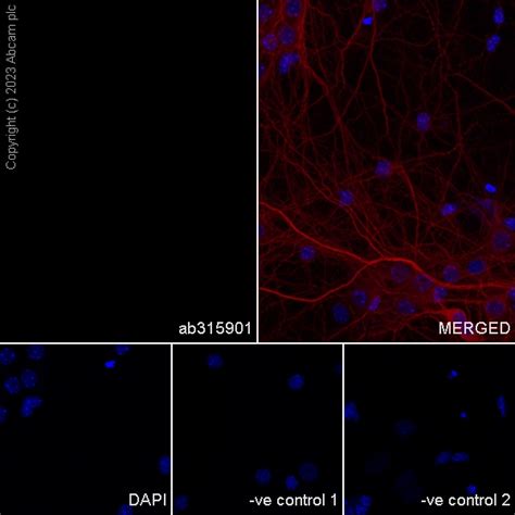 Recombinant Anti Neutrophil Elastase Antibody Epr Ab