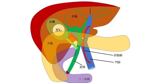 胆道がんの治療 国立がん研究センター 中央病院