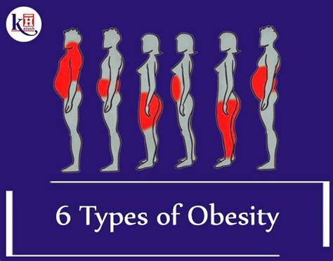 6 Types of Obesity and Solutions to overcome each