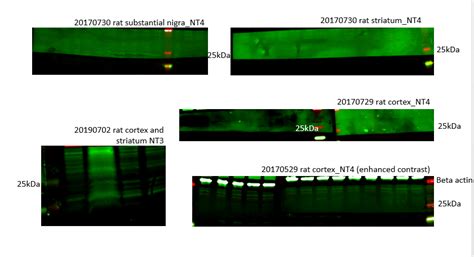 Hi Everyone Does Anyone Know The Causes Of Strong Background Of Blotting Nitrocellulose