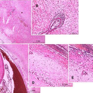 Histological findings of the brain. Exemplary H & E-stained sections ... 