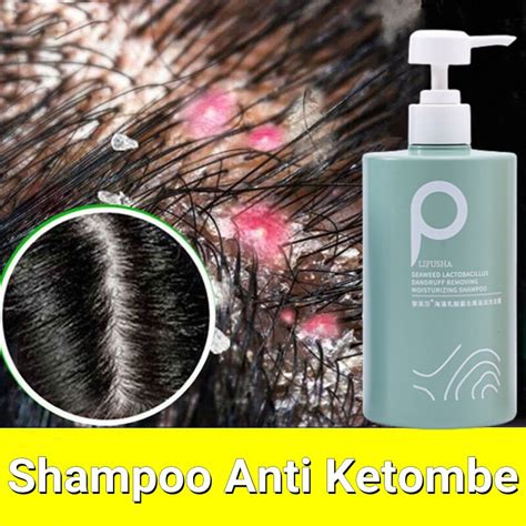 Jual Shampoo Anti Ketombe Penghilang Ketombe Sampo Garam Laut Ketombe Rambut Berkerak Anti ...