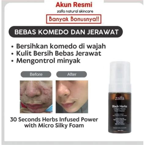 Jual Zalfa Natural Skincare Black Herbs Collagen Mousse Facial Cleanser