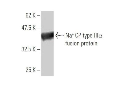 Na CP type IIIα抗体 3F3 SCBT Santa Cruz Biotechnology