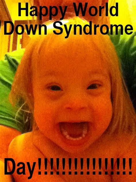 Down Syndrome Jokes